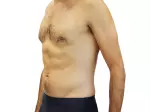 Miniatura 0
