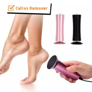Electric Foot Callus Remover – Dead Skin &amp; Heel Care Pedicur